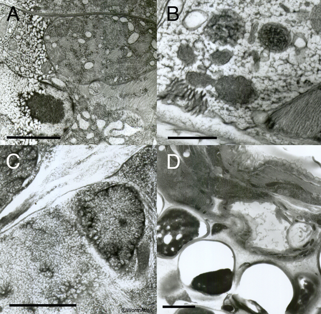 EMHPFFIG 3: Freeze artifacts in HPF/FS.